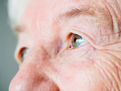 Olho seco atinge maioria dos pacientes com catarata
